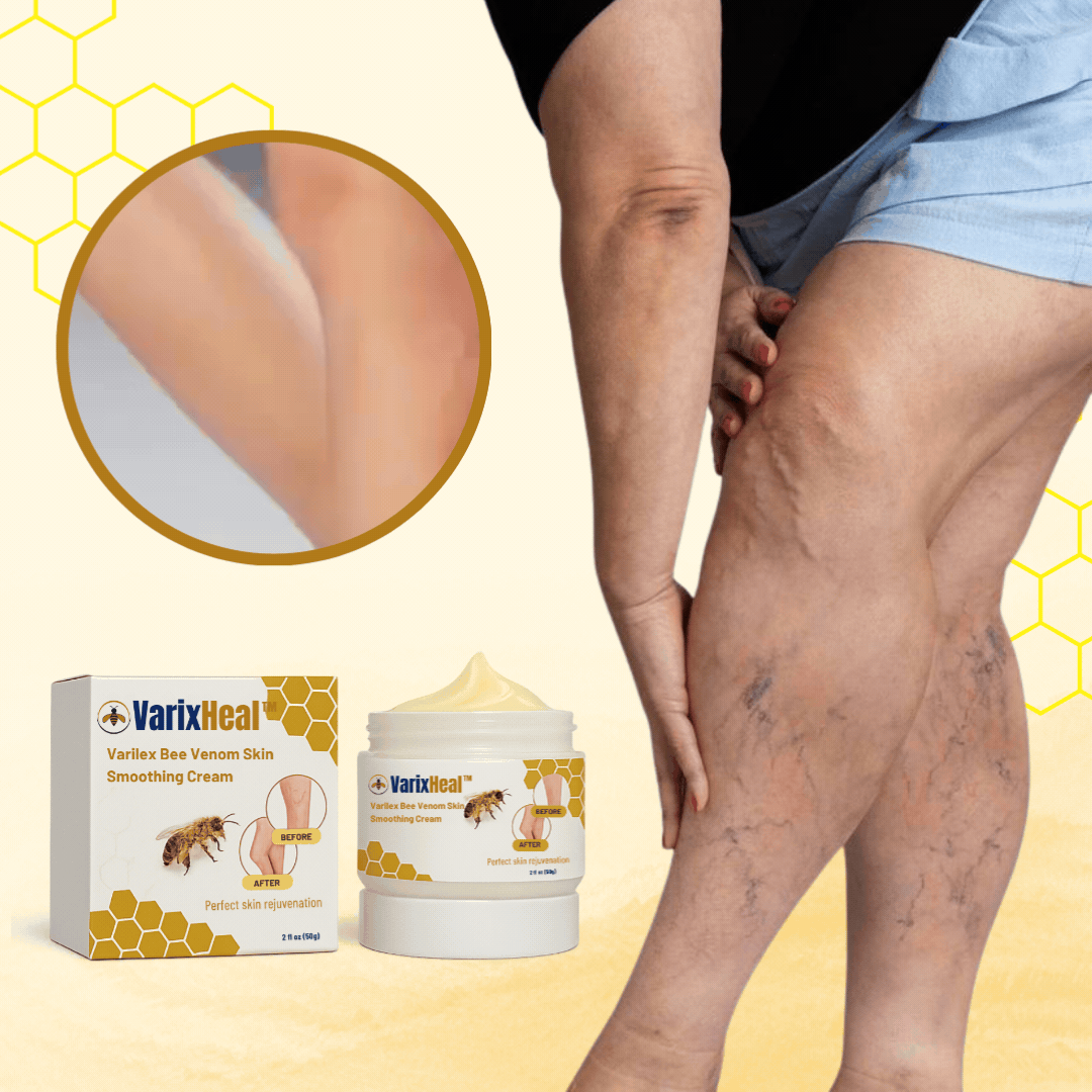 VarixHeal™
