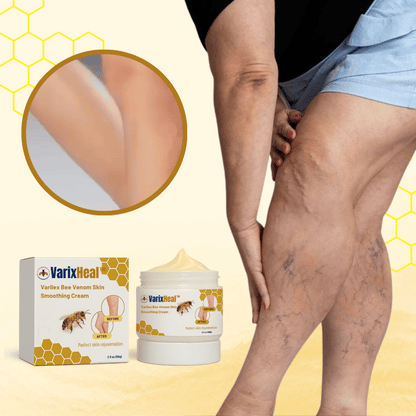 VarixHeal™