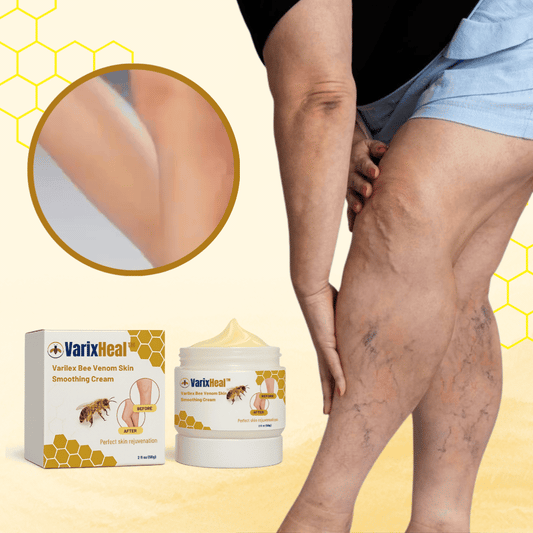 VarixHeal™