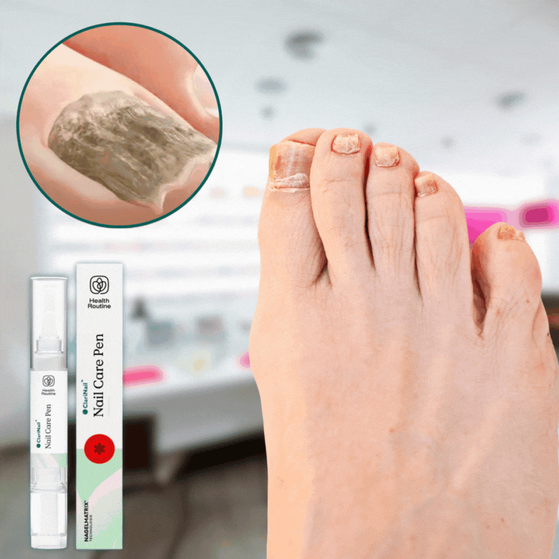 ClariNail™
