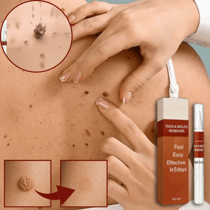EpidermaFix‏™